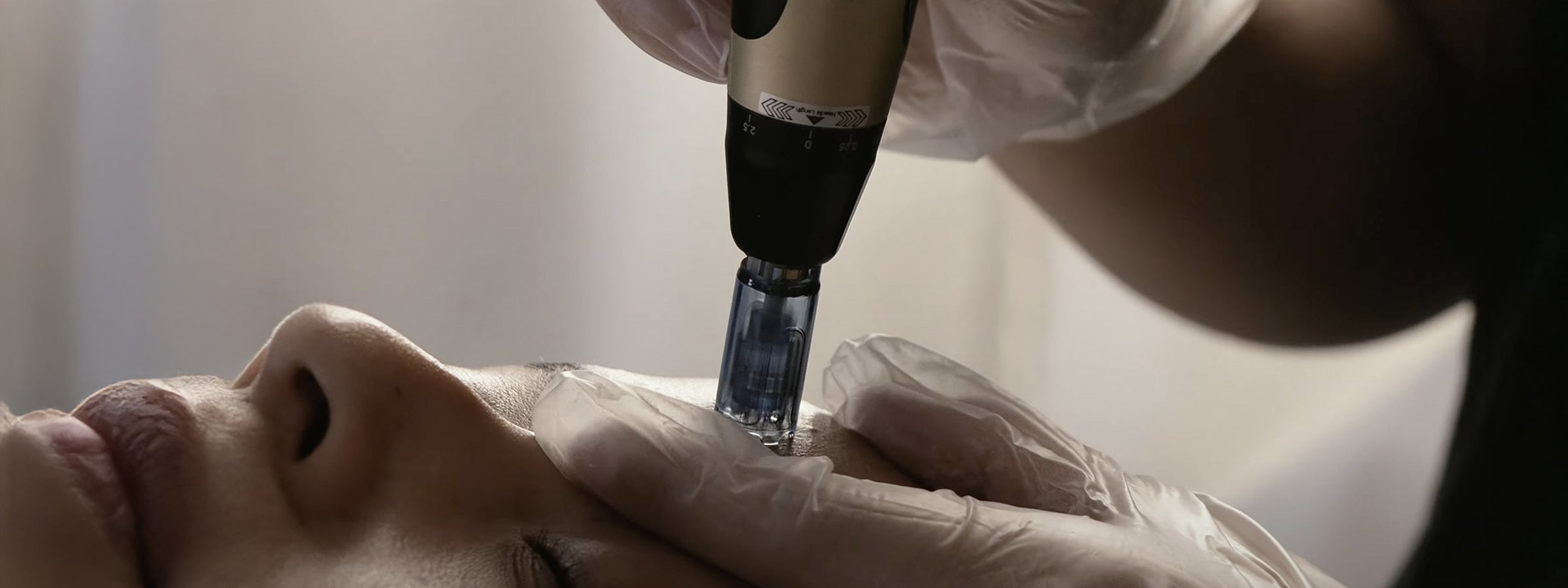 Microneedling