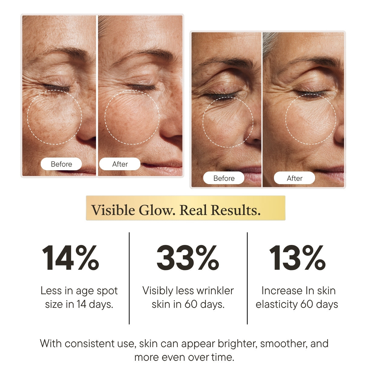 Skinact Vitamin C Brightening Serum | Before and after effects of a skincare product on skin, with visible improvements in age spots, wrinkles, and elasticity.