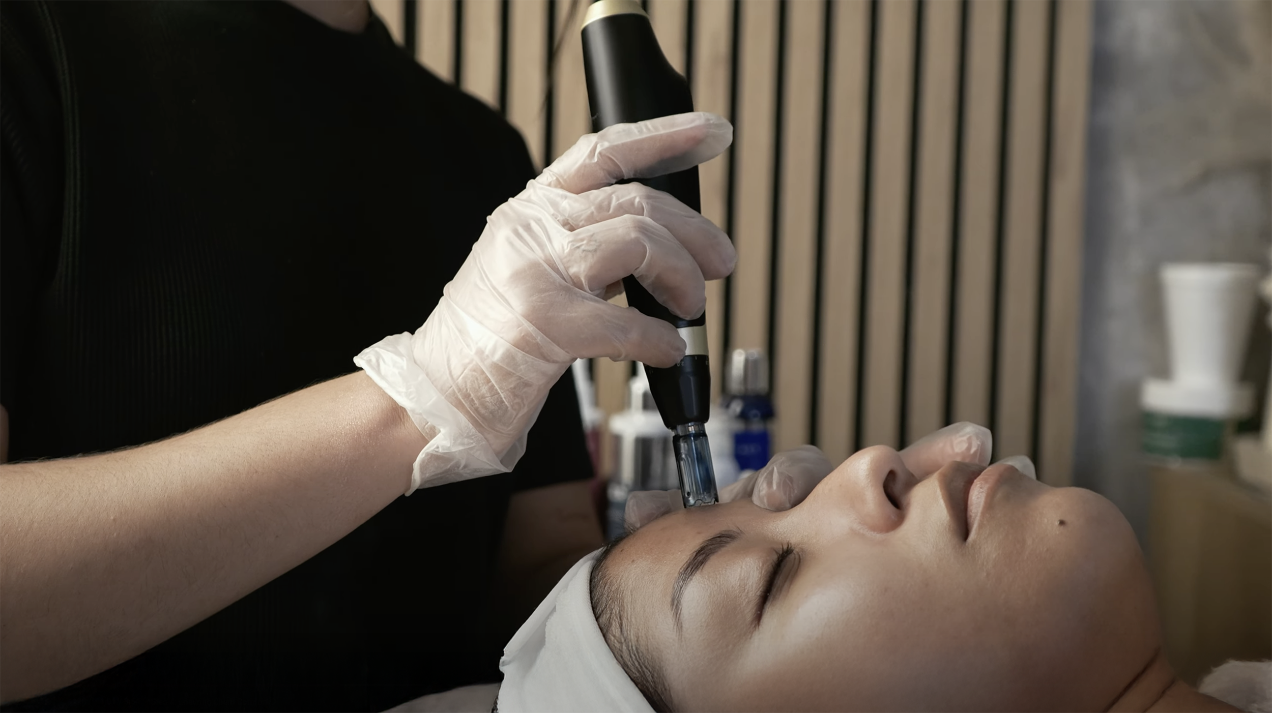 The Complete Guide to Microneedling Treatments: Techniques, Benefits, and Safety